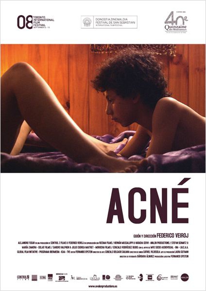 Acné  (2008)