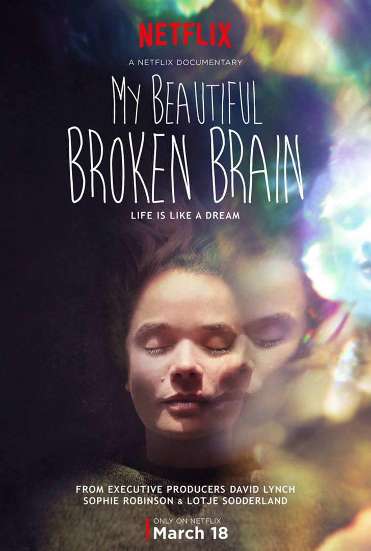 My Beautiful Broken Brain (2016)
